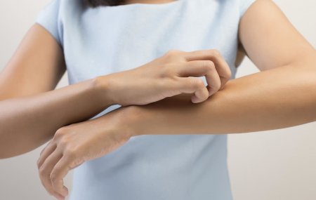 Серные мази для лечения чесотки в домашних условиях