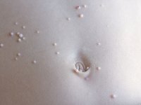 Из-за чего появляются чешущиеся водянистые пузырьки на коже?